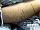 富阳80后女生腿上扎上百个窟窿减肥 为好看连命都不要了