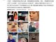 女演员整容失败鼻尖坏死 已和涉事美容门诊和解